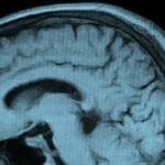 Called SPECT (single-photon emission computerized tomography), the new testing method shows blood flow throughout the brain.